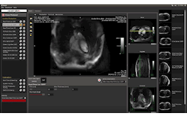 RTHawk Cardiac MRI